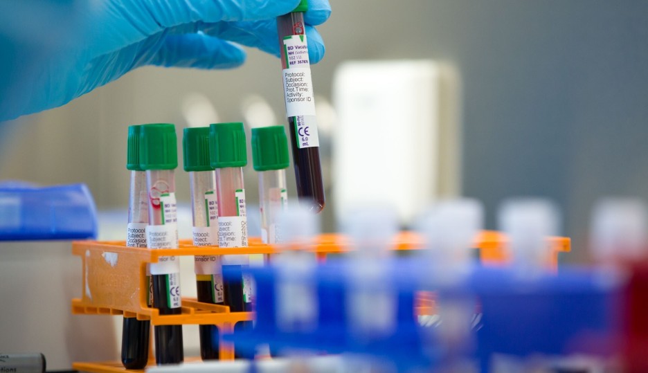 Lab methods